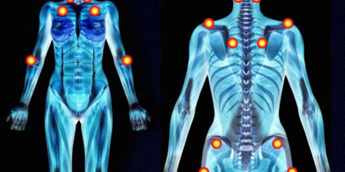 inibição miofascial